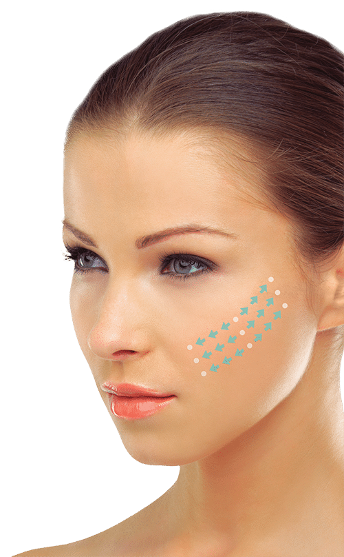 silhouette instalift in naples